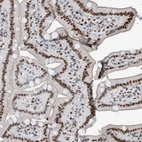 Immunohistochemical staining of human duodenum shows strong nuclear positivity in glandular cells.
