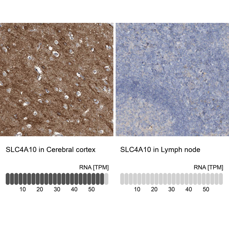 Anti-SLC4A10 Antibody