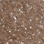 Immunohistochemical staining of human cerebral cortex shows moderate membranous positivity in neurons.