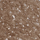 Immunohistochemical staining of human cerebral cortex shows moderate membranous positivity in neurons.
