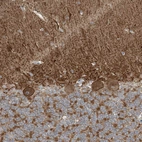 Immunohistochemical staining of human cerebellum shows strong membranous positivity in Purkinje cells.
