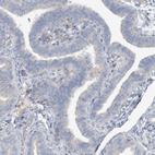 Anti-SLC4A10 Antibody