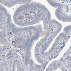 Immunohistochemical staining of human Fallopian tube shows no positivity in glandular cells as expected.