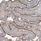 Anti-ZNF793 Antibody