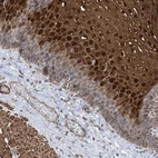 Anti-ZNF8 Antibody