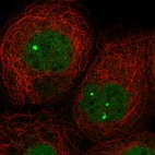 Immunofluorescent staining of human cell line A-431 shows localization to nucleoplasm & nuclear bodies.