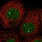 Immunofluorescent staining of human cell line A-431 shows localization to nucleoplasm & nuclear bodies.