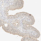 Immunohistochemical staining of human fallopian tube shows weak cytoplasmic positivity in glandular cells.