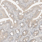 Immunohistochemical staining of human duodenum shows weak cytoplasmic positivity in glandular cells.