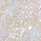Immunohistochemical staining of human kidney shows weak cytoplasmic positivity in cells in tubules.