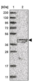 Lane 1: Marker [kDa] 230, 130, 95, 72, 56, 36, 28, 17, 11_br/_Lane 2: Human cell line RT-4