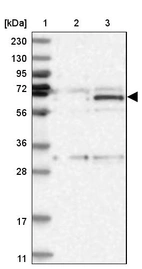 Lane 1: Marker [kDa] 230, 130, 95, 72, 56, 36, 28, 17, 11_br/_Lane 2: Human cell line RT-4_br/_Lane 3: Human cell line U-251MG sp