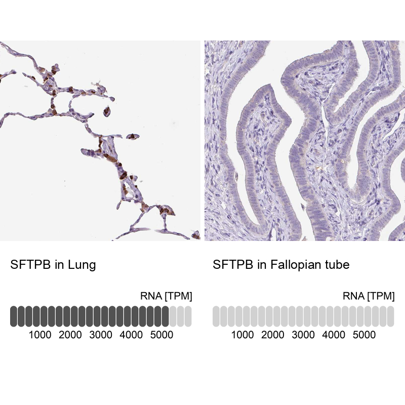 Anti-SFTPB Antibody