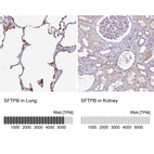 Anti-SFTPB Antibody