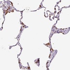 Immunohistochemical staining of human lung shows high expression.