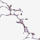 Immunohistochemical staining of human lung shows moderate cytoplasmic positivity in macrophages.