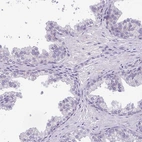 Immunohistochemical staining of human prostate shows no positivity in glandular cells as expected.