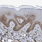 Immunohistochemical staining of human skin shows moderate to strong membranous positivity in keratinocytes.