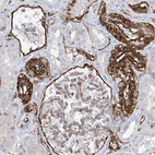 Immunohistochemical staining of human kidney shows moderate to strong membranous positivity in cells in tubules.