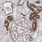 Immunohistochemical staining of human kidney shows moderate to strong membranous positivity in cells in tubules.