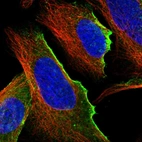 Immunofluorescent staining of human cell line U-2 OS shows localization to plasma membrane & vesicles.