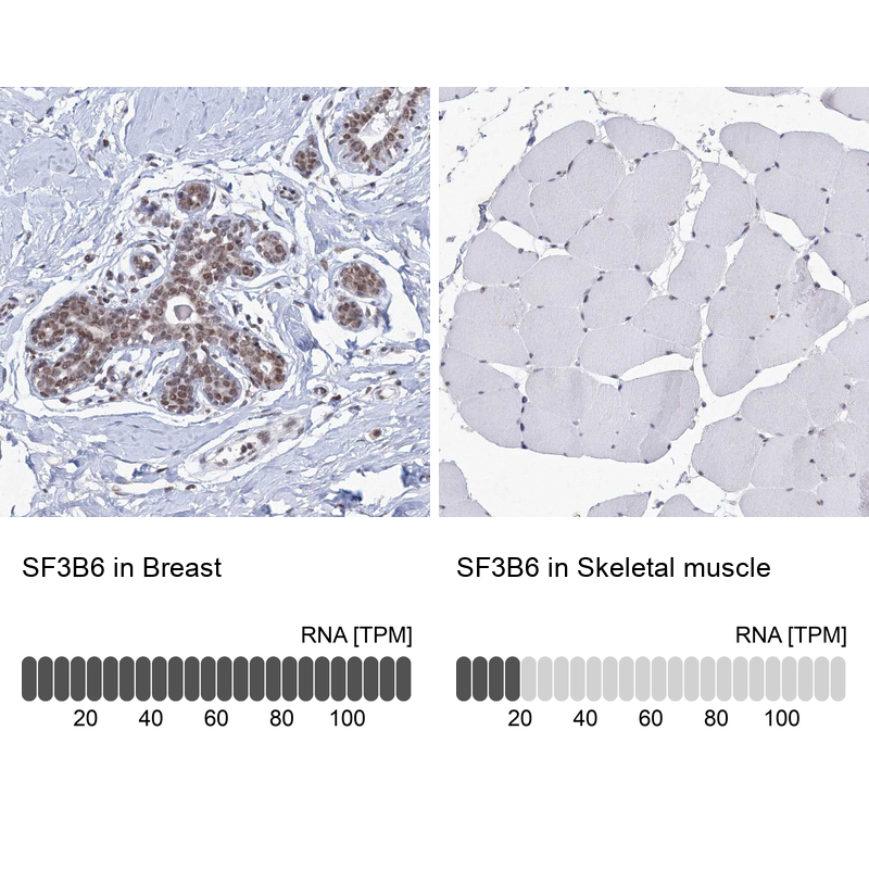 Anti-SF3B6 Antibody