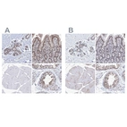 Immunohistochemical staining of human breast, colon, skeletal muscle and testis using Anti-SF3B6 antibody HPA034830 (A) shows similar protein distribution across tissues to independent antibody HPA034829 (B).