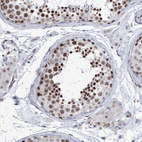 Immunohistochemical staining of human testis shows strong nuclear positivity in cells in seminiferous ducts.