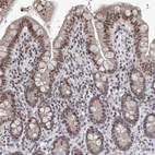 Immunohistochemical staining of human colon shows moderate nuclear positivity in glandular cells.