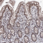 Immunohistochemical staining of human colon shows moderate nuclear positivity in glandular cells.