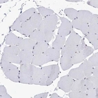 Immunohistochemical staining of human skeletal muscle shows no positivity in myocytes as expected.