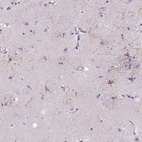 Anti-MYH15 Antibody