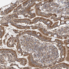 Anti-UQCC1 Antibody