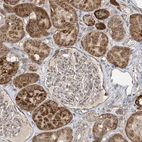 Immunohistochemical staining of human kidney shows moderate to strong cytoplasmic positivity in cells in tubules.