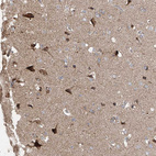 Immunohistochemical staining of human cerebral cortex shows moderate to strong cytoplasmic positivity in neurons.