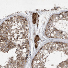 Immunohistochemical staining of human testis shows moderate to strong cytoplasmic positivity in Leydig cells.