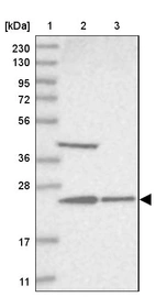 Lane 1: Marker [kDa] 230, 130, 95, 72, 56, 36, 28, 17, 11_br/_Lane 2: Human cell line RT-4_br/_Lane 3: Human cell line U-251MG sp