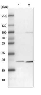 Lane 1: NIH-3T3 cell lysate (Mouse embryonic fibroblast cells)_br/_Lane 2: NBT-II cell lysate (Rat Wistar bladder tumour cells)