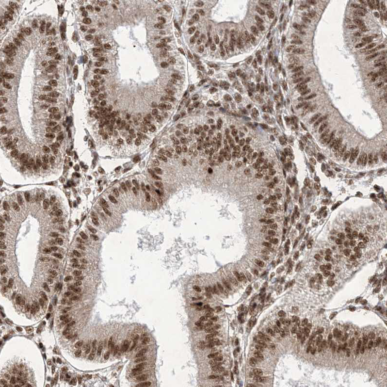 Anti-ARGLU1 Antibody