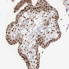 Immunohistochemical staining of human placenta shows moderate to strong nuclear positivity in trophoblastic cells.