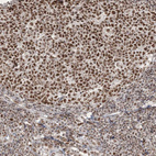 Immunohistochemical staining of human tonsil shows moderate to strong nuclear positivity in lymphoid cells.