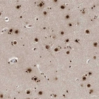 Immunohistochemical staining of human cerebral cortex shows moderate to strong nuclear positivity in neurons.