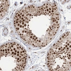 Immunohistochemical staining of human testis shows moderate to strong nuclear positivity in cells in seminiferous ducts.