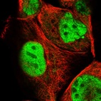 Immunofluorescent staining of human cell line A-431 shows localization to nucleoplasm.