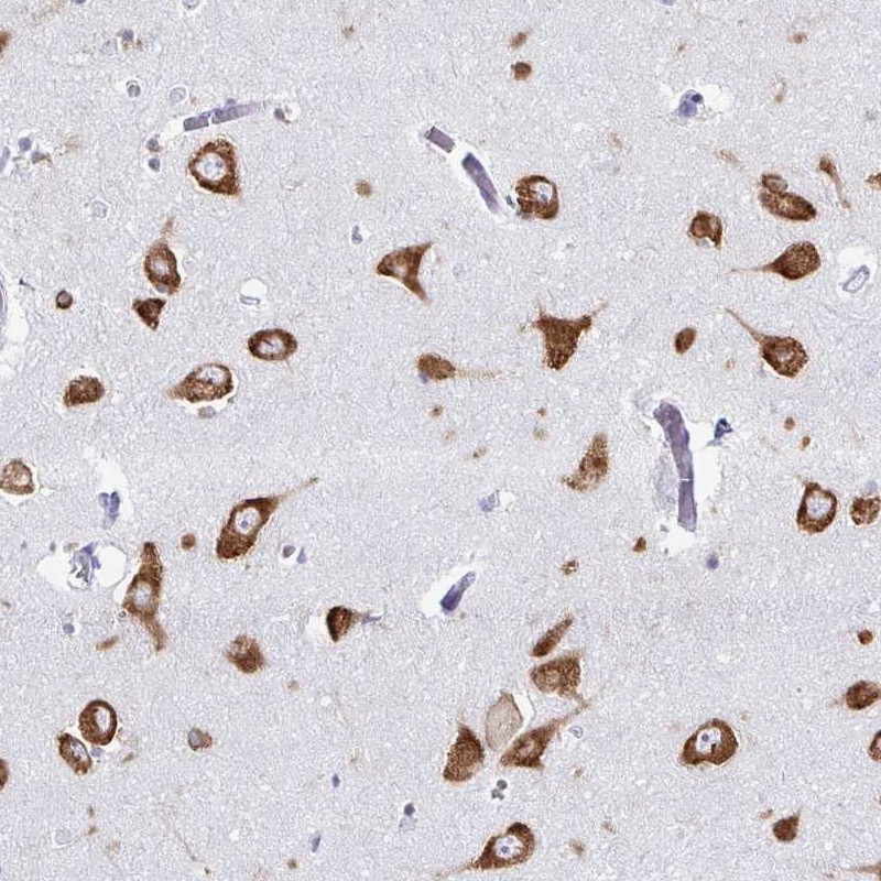 Anti-PRKRA Antibody