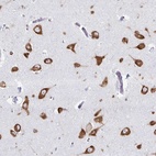 Anti-PRKRA Antibody