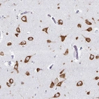 Anti-PRKRA Antibody
