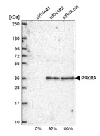 Anti-PRKRA Antibody