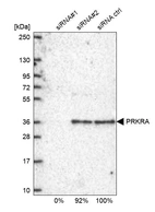 Western blot analysis in U2OS cells transfected with control siRNA, target specific siRNA probe #1 and #2, using Anti-PRKRA antibody. Remaining relative intensity is presented.