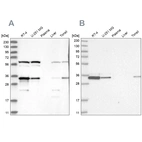 Western blot analysis using Anti-PRKRA antibody HPA034997 (A) shows similar pattern to independent antibody HPA034996 (B).